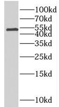 SLC44A1 Rabbit Polyclonal Antibody