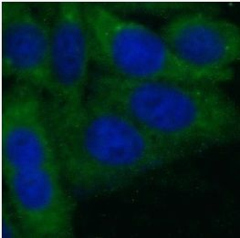 SLITRK6 Rabbit Polyclonal Antibody