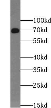 LCP2 Rabbit Polyclonal Antibody