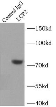 LCP2 Rabbit Polyclonal Antibody