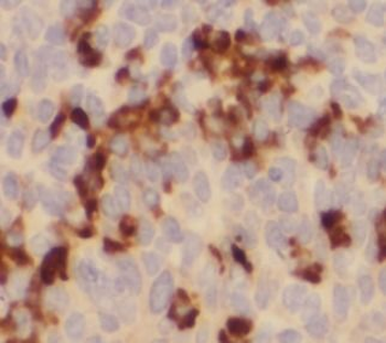 LCP2 Rabbit Polyclonal Antibody