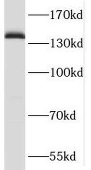 SLTM Rabbit Polyclonal Antibody