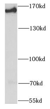 SMARCC1 Rabbit Polyclonal Antibody