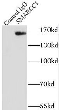 SMARCC1 Rabbit Polyclonal Antibody
