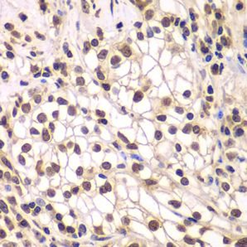 SMARCC1 Rabbit Polyclonal Antibody
