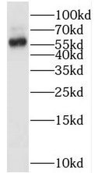 SMARCD1 Rabbit Polyclonal Antibody