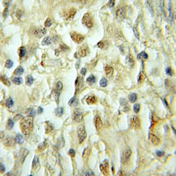SMARCD1 Rabbit Polyclonal Antibody