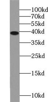 SMN1 Rabbit Polyclonal Antibody