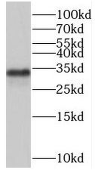 SMNDC1 Rabbit Polyclonal Antibody