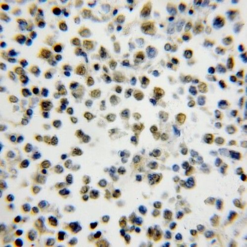 SMNDC1 Rabbit Polyclonal Antibody