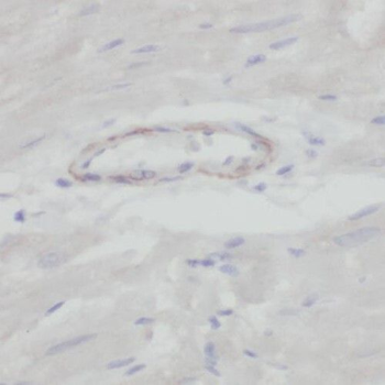 SMOX Rabbit Polyclonal Antibody