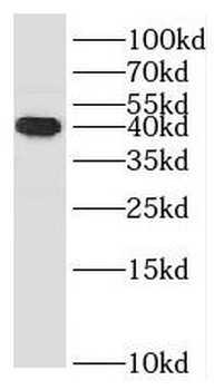 SMPDL3B Rabbit Polyclonal Antibody