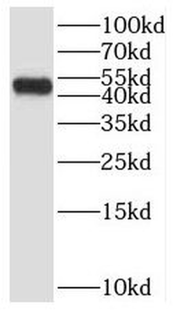 SMYD2 Rabbit Polyclonal Antibody