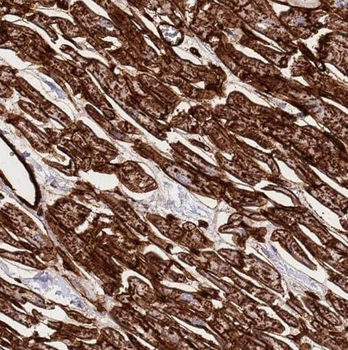 SMYD2 Rabbit Polyclonal Antibody