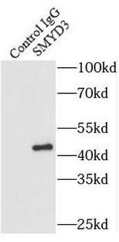 SMYD3 Rabbit Polyclonal Antibody