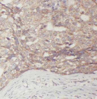 SMYD3 Rabbit Polyclonal Antibody