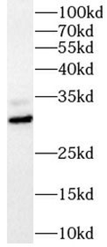 SNAI2 Rabbit Polyclonal Antibody