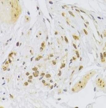SNAI2 Rabbit Polyclonal Antibody