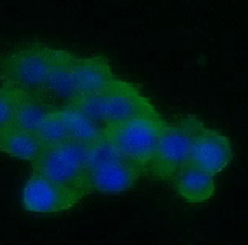 SNAP25 Rabbit Polyclonal Antibody