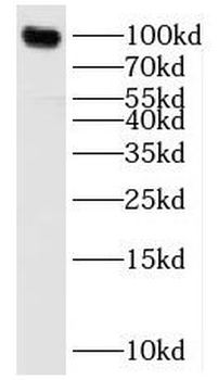 SNCAIP Rabbit Polyclonal Antibody