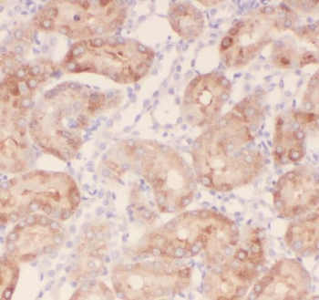 SNCAIP Rabbit Polyclonal Antibody