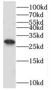 SNRPA1 Rabbit Polyclonal Antibody