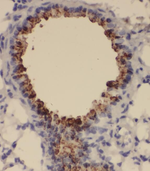 SNRPA1 Rabbit Polyclonal Antibody