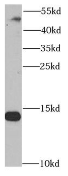 SNRPD2 Rabbit Polyclonal Antibody