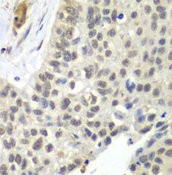 SNRPD2 Rabbit Polyclonal Antibody