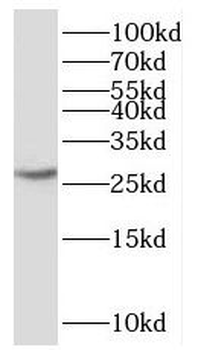 SNRPN Rabbit Polyclonal Antibody