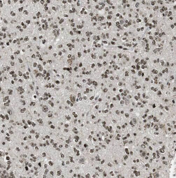 SNRPN Rabbit Polyclonal Antibody