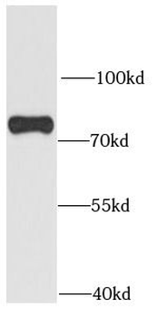 SNX1 Rabbit Polyclonal Antibody