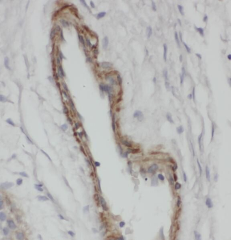 SNX1 Rabbit Polyclonal Antibody