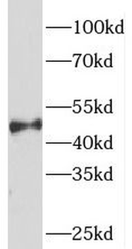 SNX6 Rabbit Polyclonal Antibody