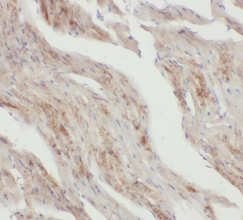 SNX6 Rabbit Polyclonal Antibody