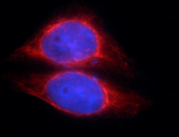 SOCS3 Rabbit Polyclonal Antibody