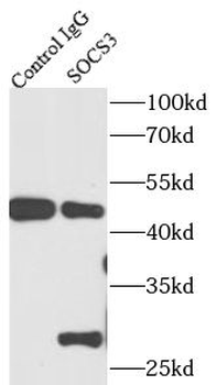 SOCS3 Rabbit Polyclonal Antibody