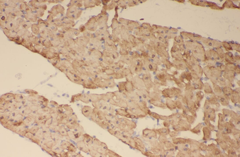 SOCS3 Rabbit Polyclonal Antibody