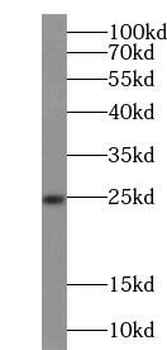 SOD2 Rabbit Polyclonal Antibody