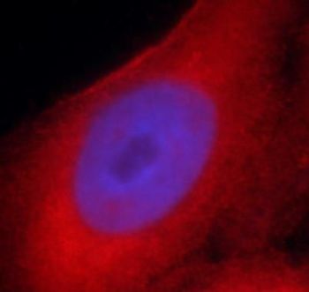 SOD2 Rabbit Polyclonal Antibody