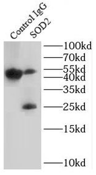 SOD2 Rabbit Polyclonal Antibody