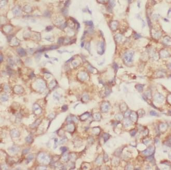 SOD2 Rabbit Polyclonal Antibody