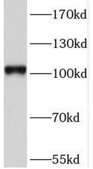 SORT1 Rabbit Polyclonal Antibody