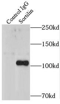 SORT1 Rabbit Polyclonal Antibody