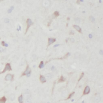 SORT1 Rabbit Polyclonal Antibody