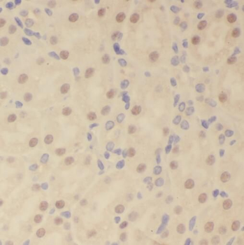 SOX13 Rabbit Polyclonal Antibody