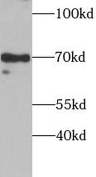 SOX5 Rabbit Polyclonal Antibody