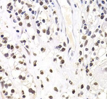 SOX5 Rabbit Polyclonal Antibody