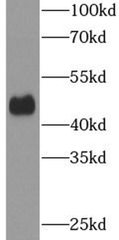 SOX8 Rabbit Polyclonal Antibody