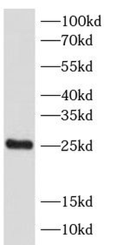 SPA17 Rabbit Polyclonal Antibody